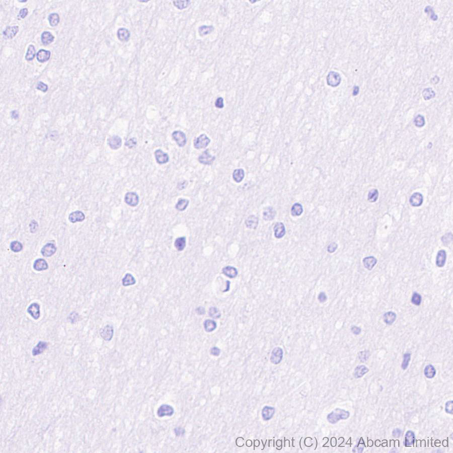 Immunohistochemistry (Formalin/PFA-fixed paraffin-embedded sections) - Anti-CD19 antibody [EPR28949-559] (ab320735), expandable thumbnail