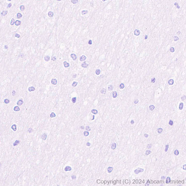 Immunohistochemistry (Formalin/PFA-fixed paraffin-embedded sections) - Anti-CD19 antibody [EPR28949-559] (AB320735)