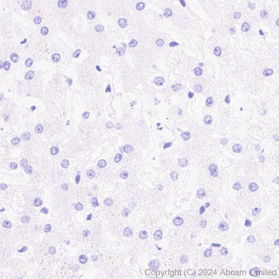 Immunohistochemistry (Formalin/PFA-fixed paraffin-embedded sections) - Anti-CD19 antibody [EPR28949-559] (ab320735), expandable thumbnail