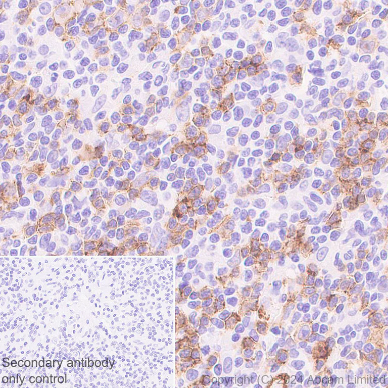 Immunohistochemistry (Formalin/PFA-fixed paraffin-embedded sections) - Anti-CD19 antibody [EPR28949-559] - BSA and Azide free (AB320736)
