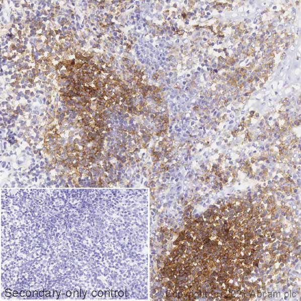 Immunohistochemistry (Frozen sections) - Anti-CD19 antibody [EPR5906] (ab134114), expandable thumbnail