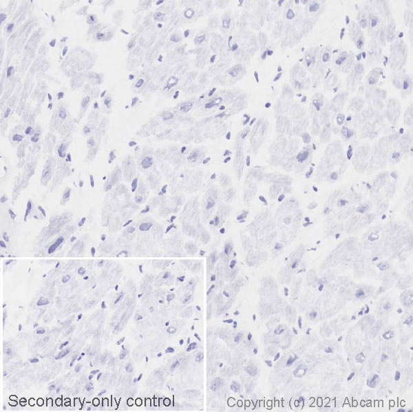 Immunohistochemistry (Frozen sections) - Anti-CD19 antibody [EPR5906] (ab134114), expandable thumbnail