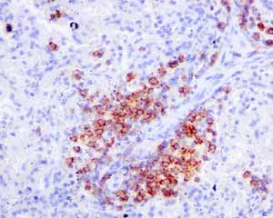 Immunohistochemistry (Formalin/PFA-fixed paraffin-embedded sections) - Anti-CD19 antibody [EPR5906] - BSA and Azide free (AB271904)