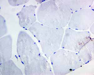 Immunohistochemistry (Formalin/PFA-fixed paraffin-embedded sections) - Anti-CD19 antibody [EPR5906] - BSA and Azide free (ab271904), expandable thumbnail