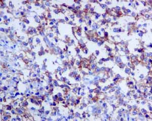 Immunohistochemistry (Formalin/PFA-fixed paraffin-embedded sections) - Anti-CD19 antibody [EPR5906] - Low endotoxin, Azide free (AB215382)