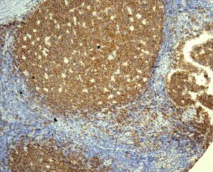 Immunohistochemistry (Formalin/PFA-fixed paraffin-embedded sections) - Anti-CD19 antibody [EPR5906] - Low endotoxin, Azide free (AB215382)