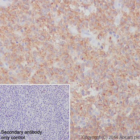 Immunohistochemistry (Formalin/PFA-fixed paraffin-embedded sections) - Anti-CD19 antibody [EPR5906] - Low endotoxin, Azide free (AB215382)
