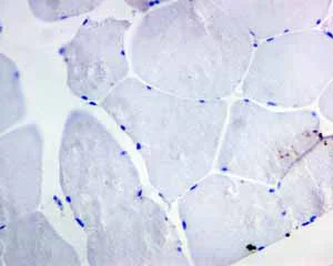 Immunohistochemistry (Formalin/PFA-fixed paraffin-embedded sections) - Anti-CD19 antibody [EPR5906] - Low endotoxin, Azide free (AB215382)