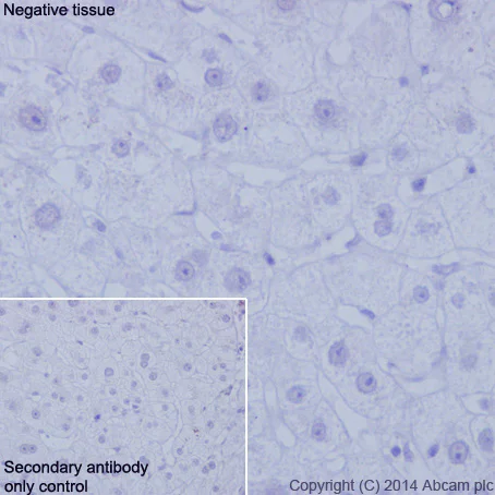 Immunohistochemistry (Formalin/PFA-fixed paraffin-embedded sections) - Anti-CD19 antibody [EPR5906] - Low endotoxin, Azide free (AB215382)