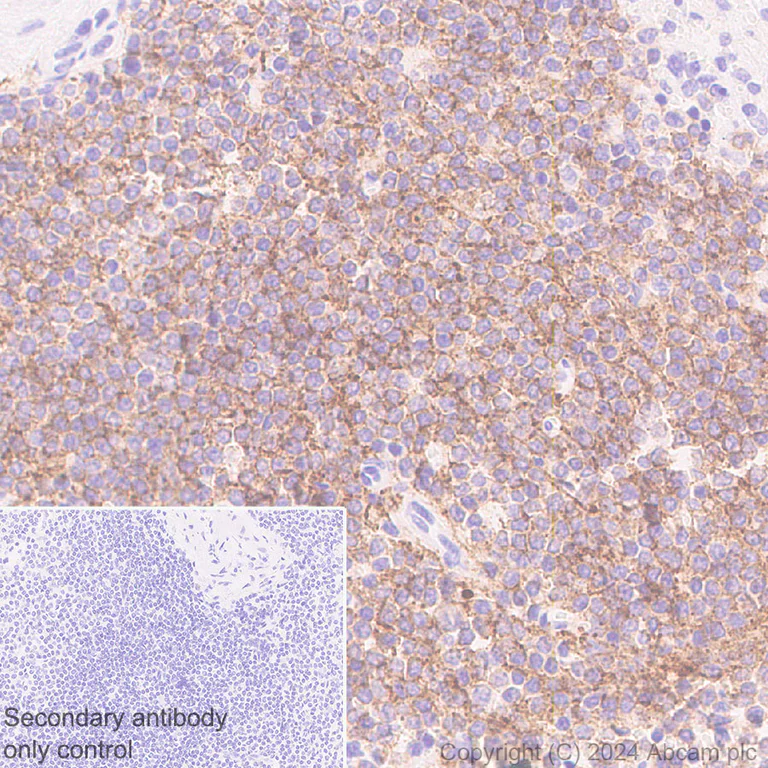 Immunohistochemistry (Formalin/PFA-fixed paraffin-embedded sections) - Anti-CD19 antibody [RM1166] - BSA and Azide free (AB317336)