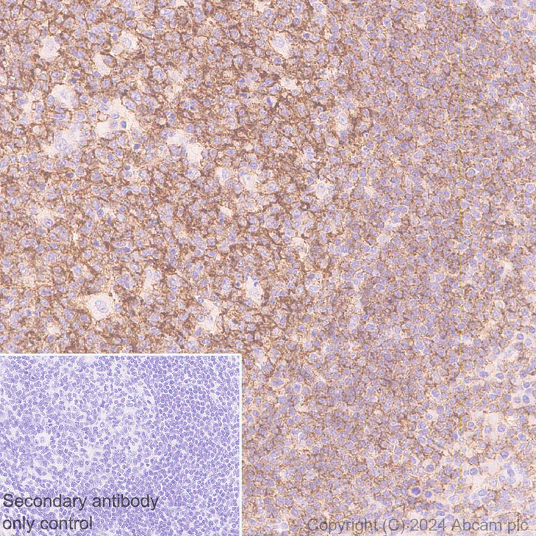 Immunohistochemistry (Formalin/PFA-fixed paraffin-embedded sections) - Anti-CD19 antibody [RM1166] - BSA and Azide free (AB317336)