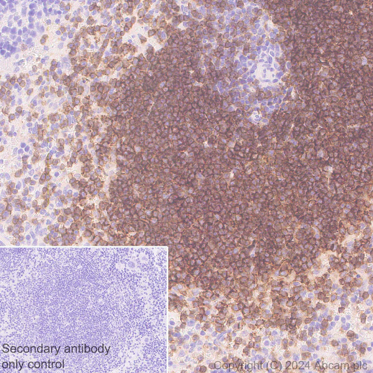 Immunohistochemistry (Formalin/PFA-fixed paraffin-embedded sections) - Anti-CD19 antibody [RM1166] - BSA and Azide free (AB317336)