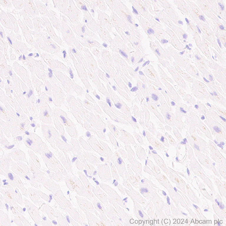 Immunohistochemistry (Formalin/PFA-fixed paraffin-embedded sections) - Anti-CD19 antibody [RM1166] - BSA and Azide free (AB317336)