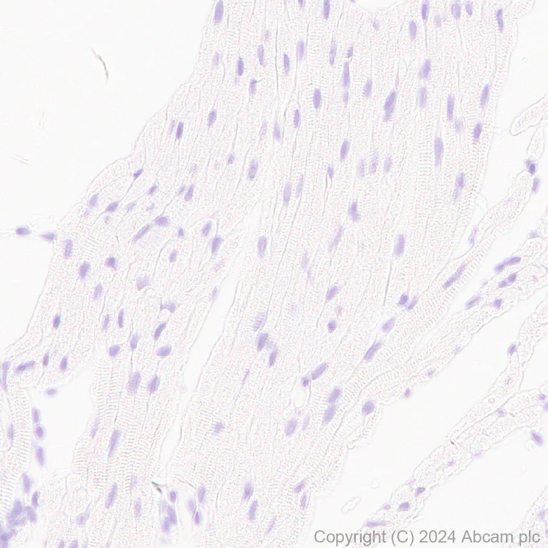 Immunohistochemistry (Formalin/PFA-fixed paraffin-embedded sections) - Anti-CD19 antibody [RM1166] - BSA and Azide free (AB317336)