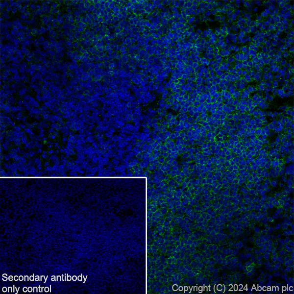 Immunohistochemistry (Frozen sections) - Anti-CD19 antibody [RM1166] - BSA and Azide free (AB317336)