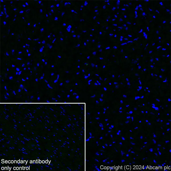 Immunohistochemistry (Frozen sections) - Anti-CD19 antibody [RM1166] - BSA and Azide free (AB317336)