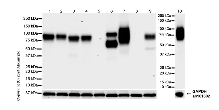 Western blot - Anti-CD19 antibody [RM1166] - BSA and Azide free (AB317336)