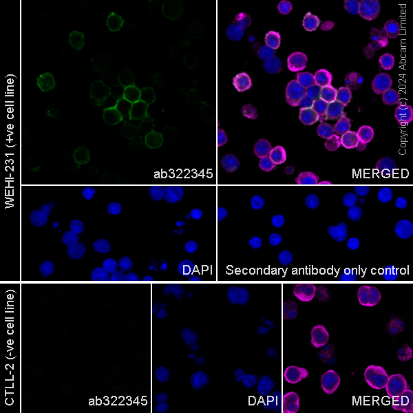 Immunocytochemistry/ Immunofluorescence - Anti-CD19 antibody [RM2072] (ab322345), expandable thumbnail