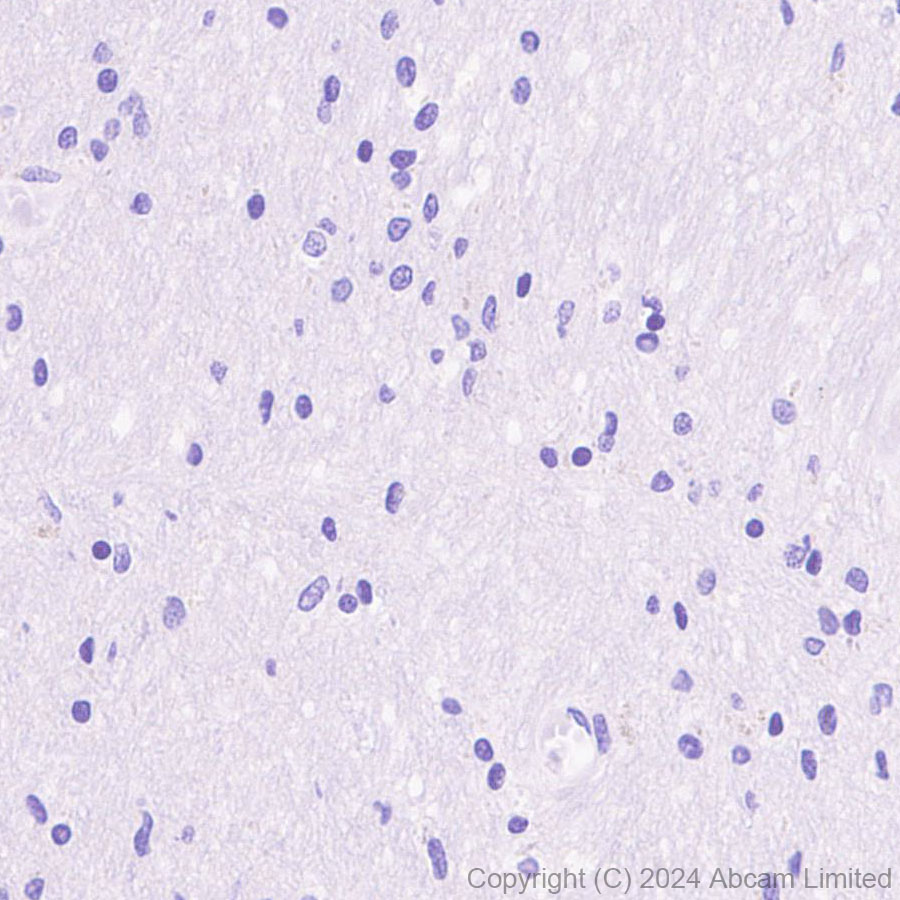 Immunohistochemistry (Formalin/PFA-fixed paraffin-embedded sections) - Anti-CD19 antibody [RM2072] (ab322345), expandable thumbnail