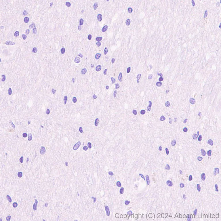 Immunohistochemistry (Formalin/PFA-fixed paraffin-embedded sections) - Anti-CD19 antibody [RM2072] (AB322345)