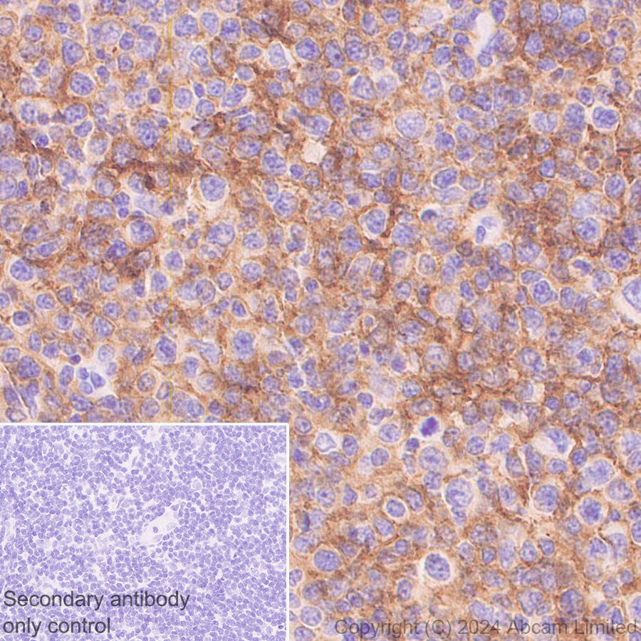 Immunohistochemistry (Formalin/PFA-fixed paraffin-embedded sections) - Anti-CD19 antibody [RM2072] (ab322345), expandable thumbnail