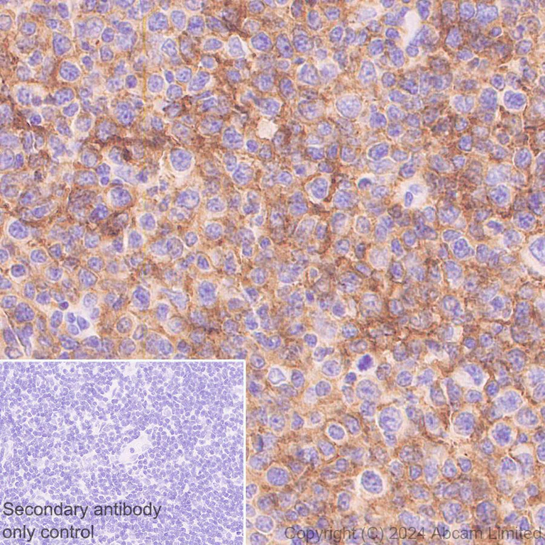 Immunohistochemistry (Formalin/PFA-fixed paraffin-embedded sections) - Anti-CD19 antibody [RM2072] (AB322345)