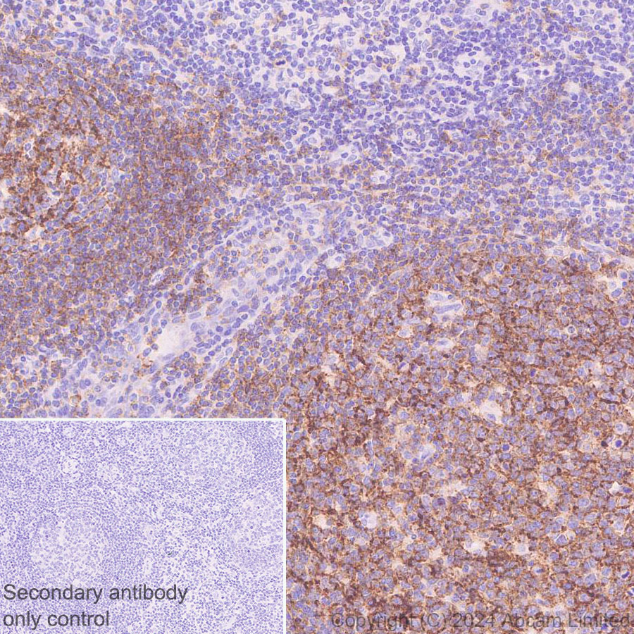 Immunohistochemistry (Formalin/PFA-fixed paraffin-embedded sections) - Anti-CD19 antibody [RM2072] (ab322345), expandable thumbnail