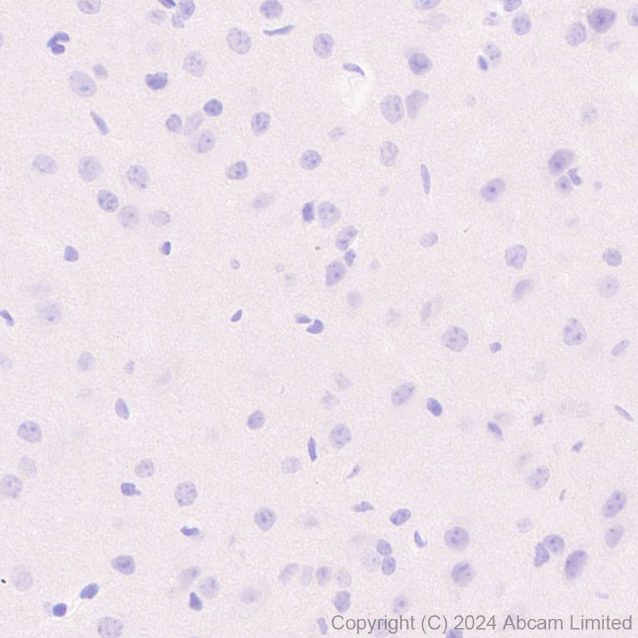 Immunohistochemistry (Formalin/PFA-fixed paraffin-embedded sections) - Anti-CD19 antibody [RM2072] (ab322345), expandable thumbnail