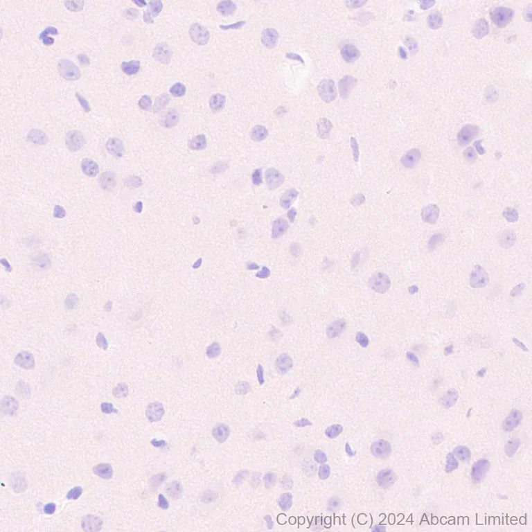 Immunohistochemistry (Formalin/PFA-fixed paraffin-embedded sections) - Anti-CD19 antibody [RM2072] (AB322345)