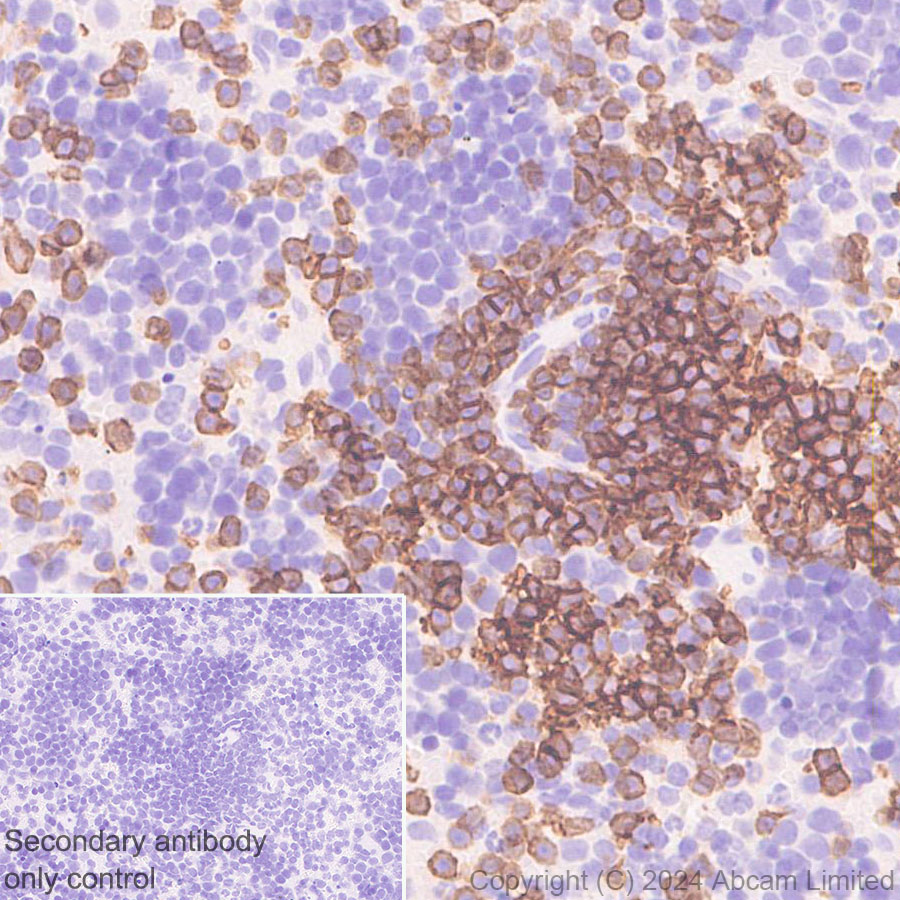 Immunohistochemistry (Formalin/PFA-fixed paraffin-embedded sections) - Anti-CD19 antibody [RM2072] (ab322345), expandable thumbnail