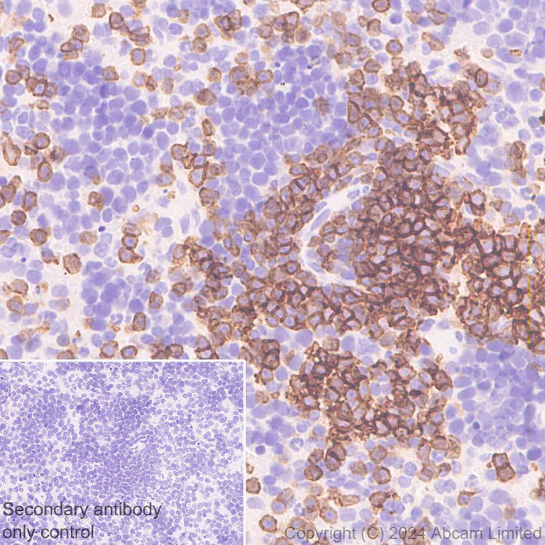 Immunohistochemistry (Formalin/PFA-fixed paraffin-embedded sections) - Anti-CD19 antibody [RM2072] (AB322345)