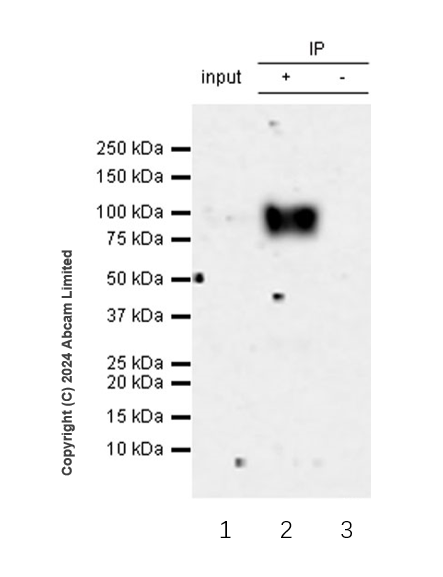 Immunoprecipitation - Anti-CD19 antibody [RM2072] (ab322345), expandable thumbnail