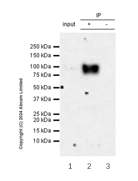 Immunoprecipitation - Anti-CD19 antibody [RM2072] (AB322345)