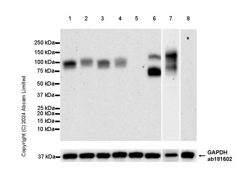 Western blot - Anti-CD19 antibody [RM2072] (AB322345), expandable thumbnail