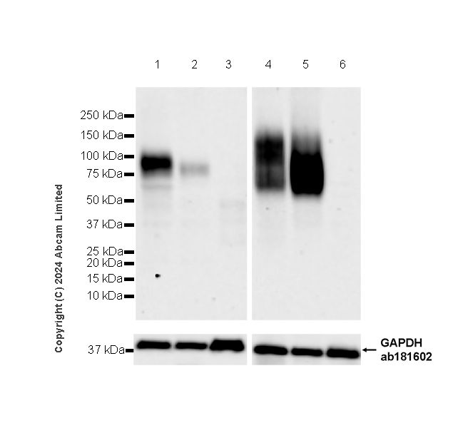 Western blot - Anti-CD19 antibody [RM2072] (AB322345), expandable thumbnail
