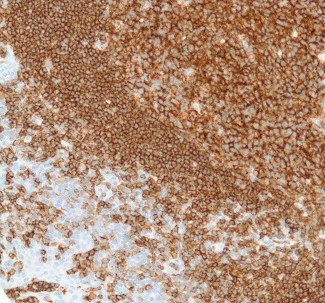 Immunohistochemistry (Formalin/PFA-fixed paraffin-embedded sections) - Anti-CD19 antibody [SP110] - BSA and Azide free (AB240402)