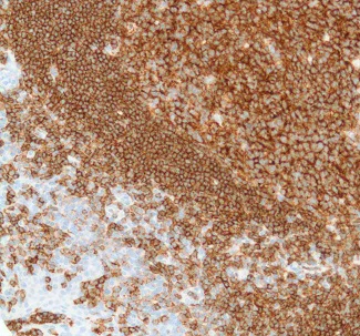 Immunohistochemistry (Formalin/PFA-fixed paraffin-embedded sections) - Anti-CD19 antibody [SP110] - C-terminal (AB225717)