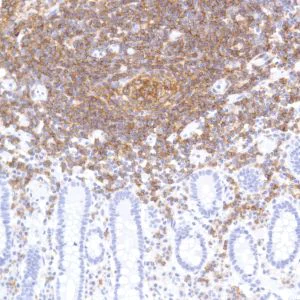 Immunohistochemistry (Formalin/PFA-fixed paraffin-embedded sections) - Anti-CD19 antibody [SP291] - BSA and Azide free (AB237772)