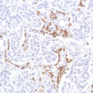 Immunohistochemistry (Formalin/PFA-fixed paraffin-embedded sections) - Anti-CD19 antibody [SP291] - BSA and Azide free (AB237772)