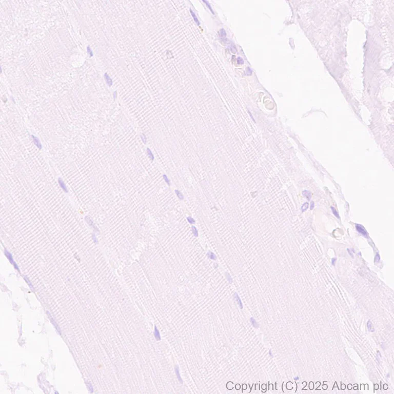 Immunohistochemistry (Formalin/PFA-fixed paraffin-embedded sections) - Anti-CD19 antibody [SP291] - BSA and Azide free (AB237772)