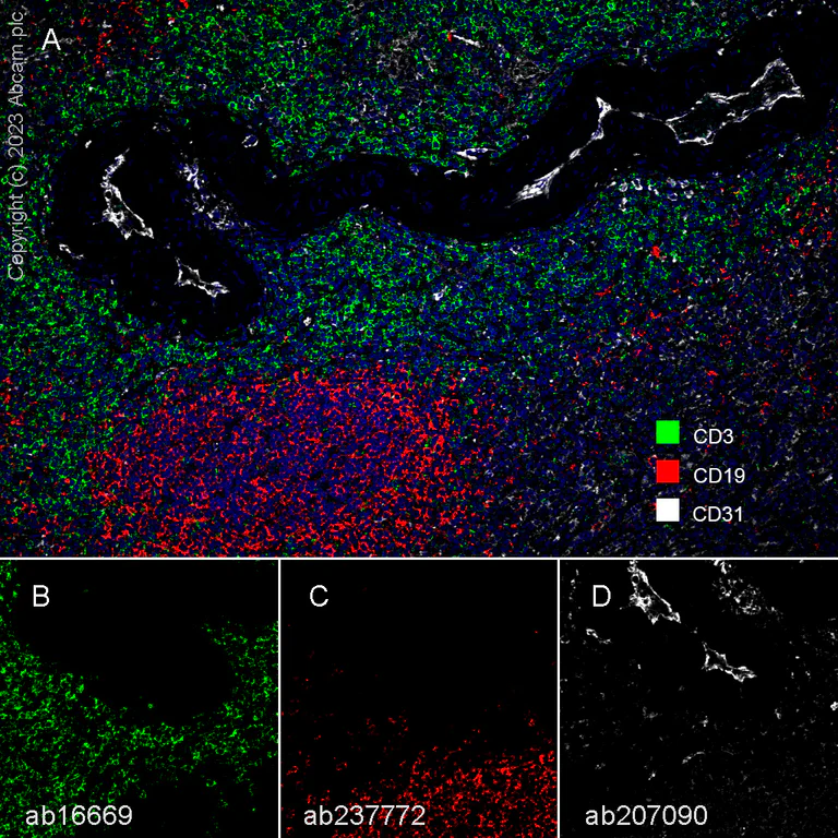 Multiplex immunohistochemistry - Anti-CD19 antibody [SP291] - BSA and Azide free (AB237772)