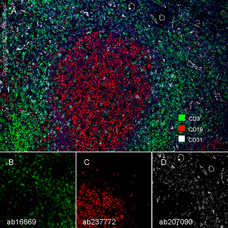 Multiplex immunohistochemistry - Anti-CD19 antibody [SP291] - BSA and Azide free (AB237772)