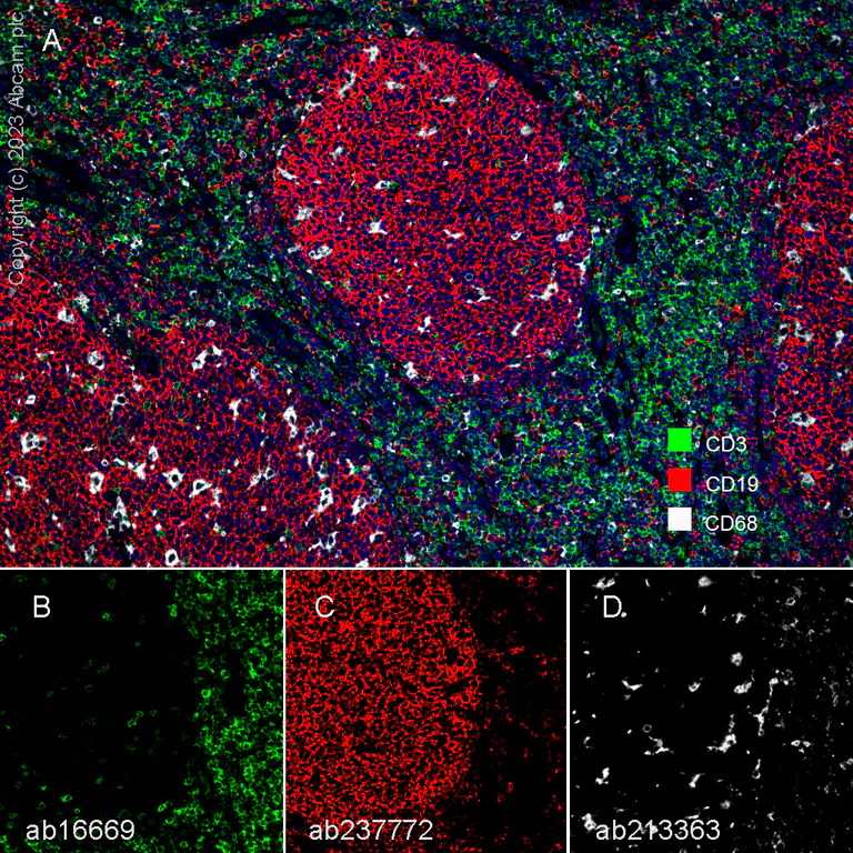 Multiplex immunohistochemistry - Anti-CD19 antibody [SP291] - BSA and Azide free (AB237772)