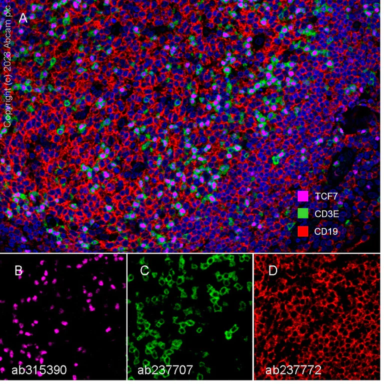 Multiplex immunohistochemistry - Anti-CD19 antibody [SP291] - BSA and Azide free (AB237772)