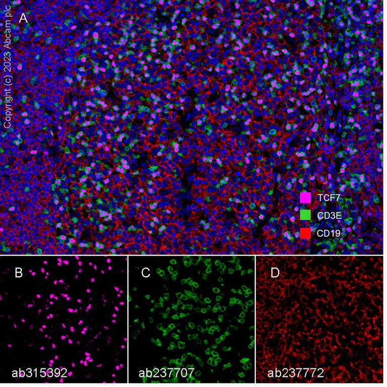 Multiplex immunohistochemistry - Anti-CD19 antibody [SP291] - BSA and Azide free (AB237772)