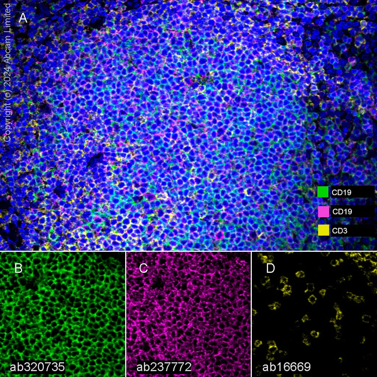 Multiplex immunohistochemistry - Anti-CD19 antibody [SP291] - BSA and Azide free (AB237772)
