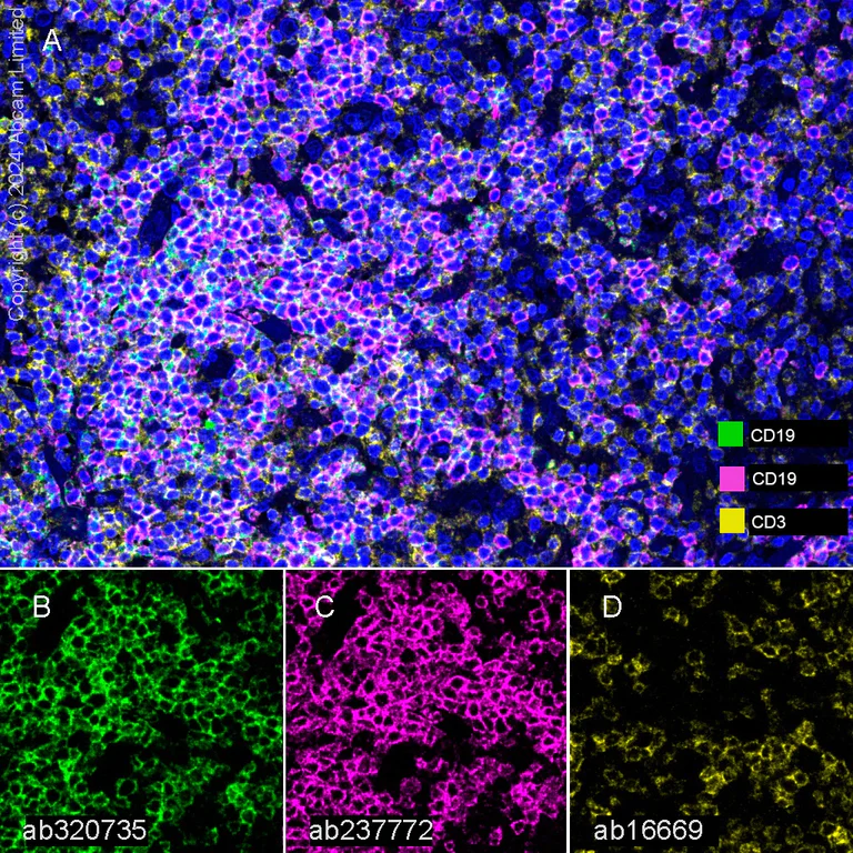 Multiplex immunohistochemistry - Anti-CD19 antibody [SP291] - BSA and Azide free (AB237772)