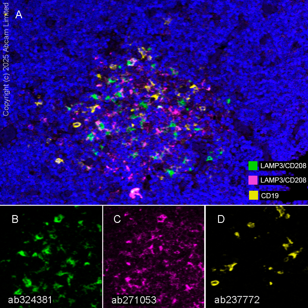 Multiplex immunohistochemistry - Anti-CD19 antibody [SP291] - BSA and Azide free (AB237772)