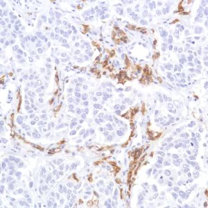 Immunohistochemistry (Formalin/PFA-fixed paraffin-embedded sections) - Anti-CD19 antibody [SP291] - C-terminal (AB227688)