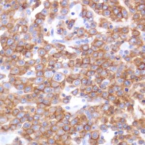 Immunohistochemistry (Formalin/PFA-fixed paraffin-embedded sections) - Anti-CD19 antibody [SP291] - C-terminal (AB227688)